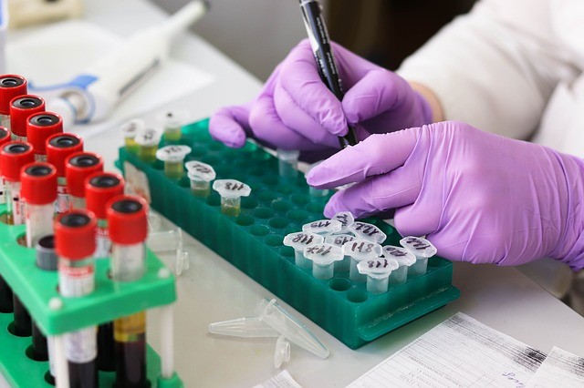 Foto de un persona haciendo pruebas en un laboratorio